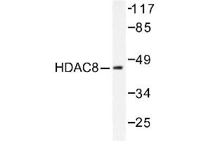 Image no. 1 for anti-Histone Deacetylase 8 (HDAC8) antibody (ABIN265460) (HDAC8 抗体)