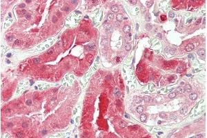 Immunohistochemistry (IHC) image for anti-Signal Transducer and Activator of Transcription 3 (Acute-Phase Response Factor) (STAT3) (Internal Region) antibody (ABIN185692)