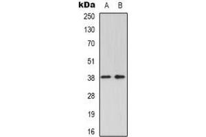 Western blot analysis of GRAP2 expression in K562 (A), Jurkat (B) whole cell lysates. (GRAP2 抗体)