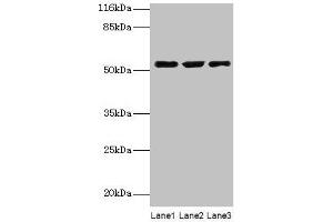 Western blot All lanes: CRNN antibody at 12 μg/mL Lane 1: HepG2 whole cell lysate Lane 2: Mouse heart tissue Lane 3: Rat skeletal muscle tissue Secondary Goat polyclonal to rabbit IgG at 1/10000 dilution Predicted band size: 54 kDa Observed band size: 54 kDa (CRNN 抗体  (AA 139-389))