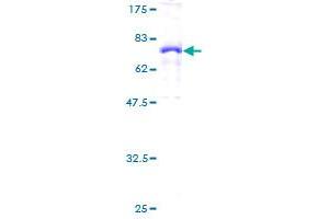 Image no. 1 for Complement Factor H (CFH) (AA 20-449) protein (GST tag) (ABIN1349204) (Complement Factor H Protein (CFH) (AA 20-449) (GST tag))