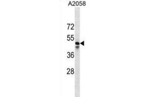 Western Blotting (WB) image for anti-MAS-Related GPR, Member F (Mrgprf) antibody (ABIN3000137)