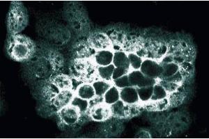 Immunofluorescence staining of A431 cells (ALOX5 抗体  (AA 442-590))