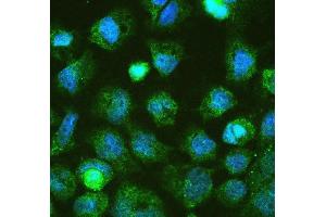 IF analysis of DGCR8 using anti-DGCR8 antibody (ABIN5692841). (DGCR8 抗体  (AA 561-762))