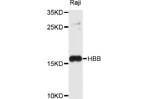 Western blot analysis of extracts of Raji cells, using HBB antibody (ABIN4903870) at 1:1000 dilution. (Hemoglobin Subunit beta 抗体)
