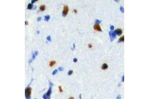 Immunohistochemical analysis of SRSF5 staining in human brain formalin fixed paraffin embedded tissue section. (SRSF5 抗体)