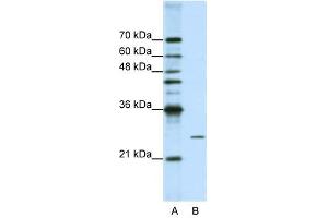 POP4 antibody used at 1. (RPP29 抗体)