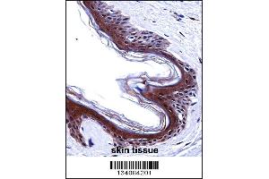SMARCE1 Antibody immunohistochemistry analysis in formalin fixed and paraffin embedded human skin tissue followed by peroxidase conjugation of the secondary antibody and DAB staining. (SMARCE1 抗体  (C-Term))