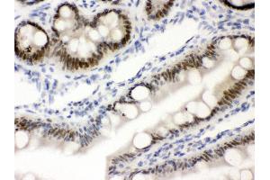 Immunohistochemistry (IHC) image for anti-Vitamin D Receptor (VDR) (AA 377-402), (C-Term) antibody (ABIN3043960)