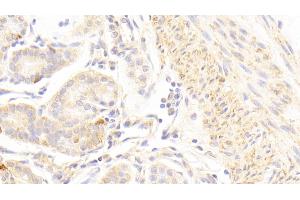 Detection of GRM1 in Human Stomach Tissue using Polyclonal Antibody to Glutamate Receptor, Metabotropic 1 (GRM1) (Metabotropic Glutamate Receptor 1 抗体  (AA 165-592))