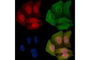 Phospho-MEKK1 (Thr1400) Antibody staining Hela cells(45 min of heat-shock treatment) by IF/ICC. (MAP3K1 抗体  (pThr1400))