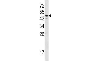 Western Blotting (WB) image for anti-Serpin Family A Member 7 (SERPINA7) antibody (ABIN3002767) (SERPINA7 抗体)