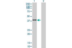 Western Blot analysis of ZNF783 expression in transfected 293T cell line by ZNF783 MaxPab polyclonal antibody. (ZNF783 抗体  (AA 1-281))