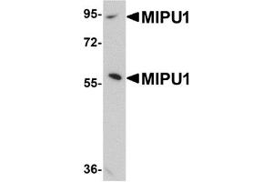 Western Blotting (WB) image for anti-Zinc Finger Protein 667 (ZNF667) (N-Term) antibody (ABIN1031458) (ZNF667 抗体  (N-Term))