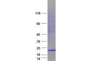 Trafficking Protein Particle Complex 2 (TRAPPC2) (Transcript Variant 1) protein (Myc-DYKDDDDK Tag)