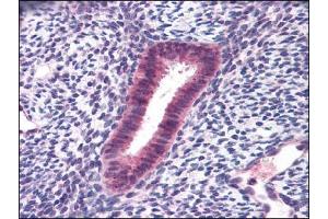Human Uterus: Formalin-Fixed, Paraffin-Embedded (FFPE) (FOXN1 抗体)