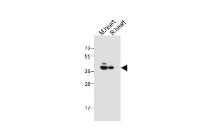 All lanes : Anti-LR6 Antibody (Center) at 1:1000 dilution Lane 1: Mouse heart tissue lysate Lane 2: Rat heart tissue lysate Lysates/proteins at 20 μg per lane. (LPAR6 抗体  (AA 106-134))