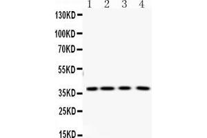 Western blot analysis of PNP using anti-PNP antibody . (PNP 抗体  (Middle Region))