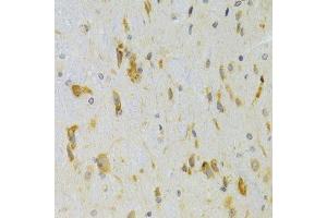 Immunohistochemistry of paraffin-embedded rat spinal cord using SCO2 Antibody. (SCO2 抗体  (AA 1-130))