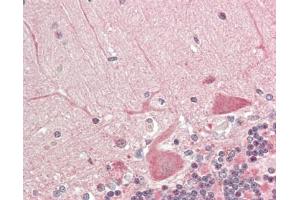 Immunohistochemistry (Paraffin-embedded Sections) (IHC (p)) image for anti-Dynein, Light Chain, LC8-Type 1 (DYNLL1) antibody (HRP) (ABIN1958087)