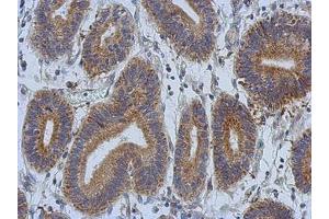 Image no. 1 for anti-Discoidin, CUB and LCCL Domain Containing 2 (DCBLD2) (AA 489-750) antibody (ABIN1497772) (DCBLD2 抗体  (AA 489-750))