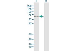 Western Blot analysis of SLC27A5 expression in transfected 293T cell line by SLC27A5 monoclonal antibody (M01), clone 5A7. (SLC27A5 抗体  (AA 90-175))