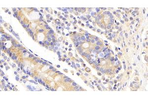 Detection of UBE2S in Human Small intestine Tissue using Polyclonal Antibody to Ubiquitin Conjugating Enzyme E2S (UBE2S) (UBE2S 抗体  (AA 1-209))