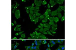 Immunofluorescence analysis of HeLa cells using DBN1 Polyclonal Antibody (DBN1 抗体)