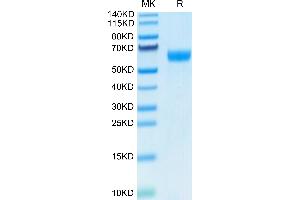 Human Ephrin B2 on Tris-Bis PAGE under reduced condition. (Ephrin B2 Protein (EFNB2) (AA 28-229) (Fc Tag))