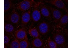 Immunofluorescence staining of methanol-fixed MCF cells using IGF-1R(Phospho-Tyr1165/Tyr1166) Antibody. (IGF1R 抗体  (pTyr1165, pTyr1166))