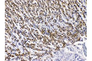 Immunohistochemistry (IHC) image for anti-Aldo-Keto Reductase Family 1, Member B1 (Aldose Reductase) (AKR1B1) (AA 228-316) antibody (ABIN4886447)