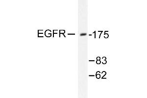 Image no. 1 for anti-Epidermal Growth Factor Receptor (EGFR) antibody (ABIN265395) (EGFR 抗体)