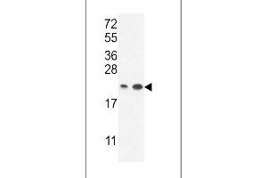 Western blot analysis in A2058,T47D cell line lysates (35ug/lane). (ABHD14B 抗体  (C-Term))