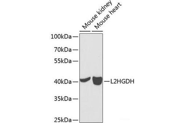 L2HGDH 抗体