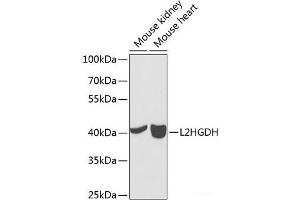 Western blot analysis of extracts of various cell lines using L2HGDH Polyclonal Antibody at dilution of 1:1000. (L2HGDH 抗体)