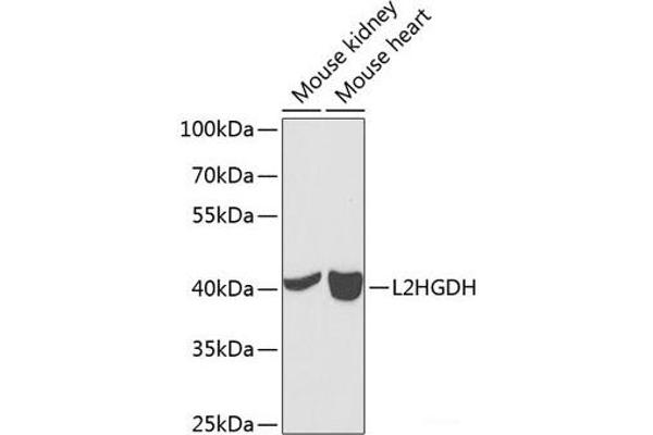 L2HGDH anticorps