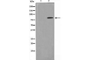 Western blot analysis on HeLa cell lysate using ZNF225 Antibody,The lane on the left is treated with the antigen-specific peptide. (ZNF225 抗体  (C-Term))