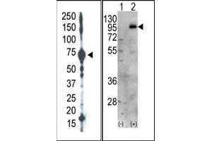 Image no. 1 for anti-Phosphatidylinositol-4-Phosphate 5-Kinase, Type I, gamma (PIP5K1C) (C-Term) antibody (ABIN360481) (PIP5K1C 抗体  (C-Term))