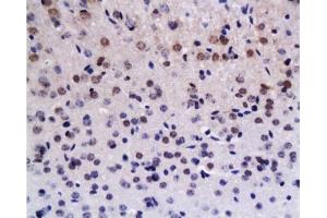 Formalin-fixed and paraffin embedded rat brain tissue labeled with Anti-Brdu Polyclonal Antibody , Unconjugated at 1:200, followed by conjugation to the secondary antibody and DAB staining (BrdU 抗体)