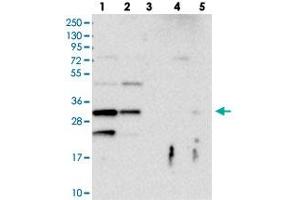 Western blot analysis of Lane 1: RT-4, Lane 2: U-251 MG, Lane 3: Human Plasma, Lane 4: Liver, Lane 5: Tonsil with FAM125A polyclonal antibody  at 1:100-1:250 dilution. (FAM125A 抗体)