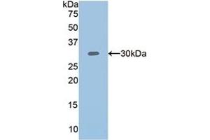 Detection of Recombinant PLS3, Human using Polyclonal Antibody to Plastin 3 (PLS3) (Plastin 3 抗体  (AA 379-630))