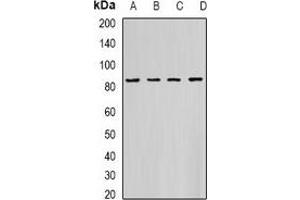 Western blot analysis of HADHA expression in K562 (A), PC3 (B), Hela (C), mouse heart (D) whole cell lysates. (HADHA 抗体)