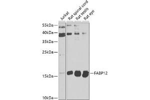 Western blot analysis of extracts of various cell lines, using F antibody  at 1:1000 dilution. (FABP12 抗体  (AA 1-140))