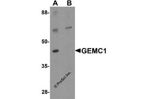 Western Blotting (WB) image for anti-Geminin Coiled-Coil Domain Containing (GMNC) (Middle Region) antibody (ABIN1030936) (GEMC1 抗体  (Middle Region))