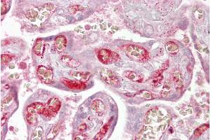 Immunohistochemistry (IHC) image for anti-Protein Phosphatase 2, Regulatory Subunit B'', alpha (PPP2R3A) (N-Term) antibody (ABIN2786686)