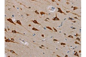 The image is immunohistochemistry of paraffin-embedded Human brain tissue using ABIN7131284(TAB3 Antibody) at dilution 1/25. (TAB3 抗体)