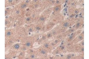 Detection of SMC3 in Human Liver Tissue using Polyclonal Antibody to Structural Maintenance Of Chromosomes Protein 3 (SMC3) (SMC3 抗体  (AA 994-1181))