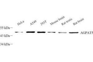 Western blot analysis of AGPAT5 (ABIN7072838) at dilution of 1: 300 (AGPAT5 抗体)