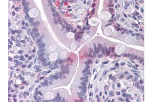 Immunohistochemical analysis of paraffin-embedded human Small Intestine tissues using FABP2 mouse mAb
