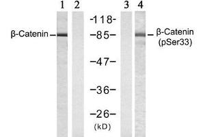 Western blot analysis of extracts from SW 626 cells , untreated or treated with Calyculin A (50nM, 30min), using β-Catenin (Ab-33) antibody (E021211, Lane 1 and 2) and β-Catenin (phospho-Ser33) antibody (E011218, Lane 3 and 4). (beta Catenin 抗体  (pSer33))
